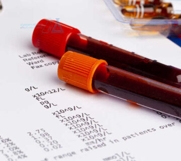 آزمایش های مربوط به بیماری های متابولیک